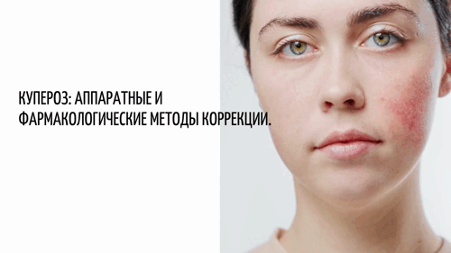 Купероз: новые технологии и эффективные решения